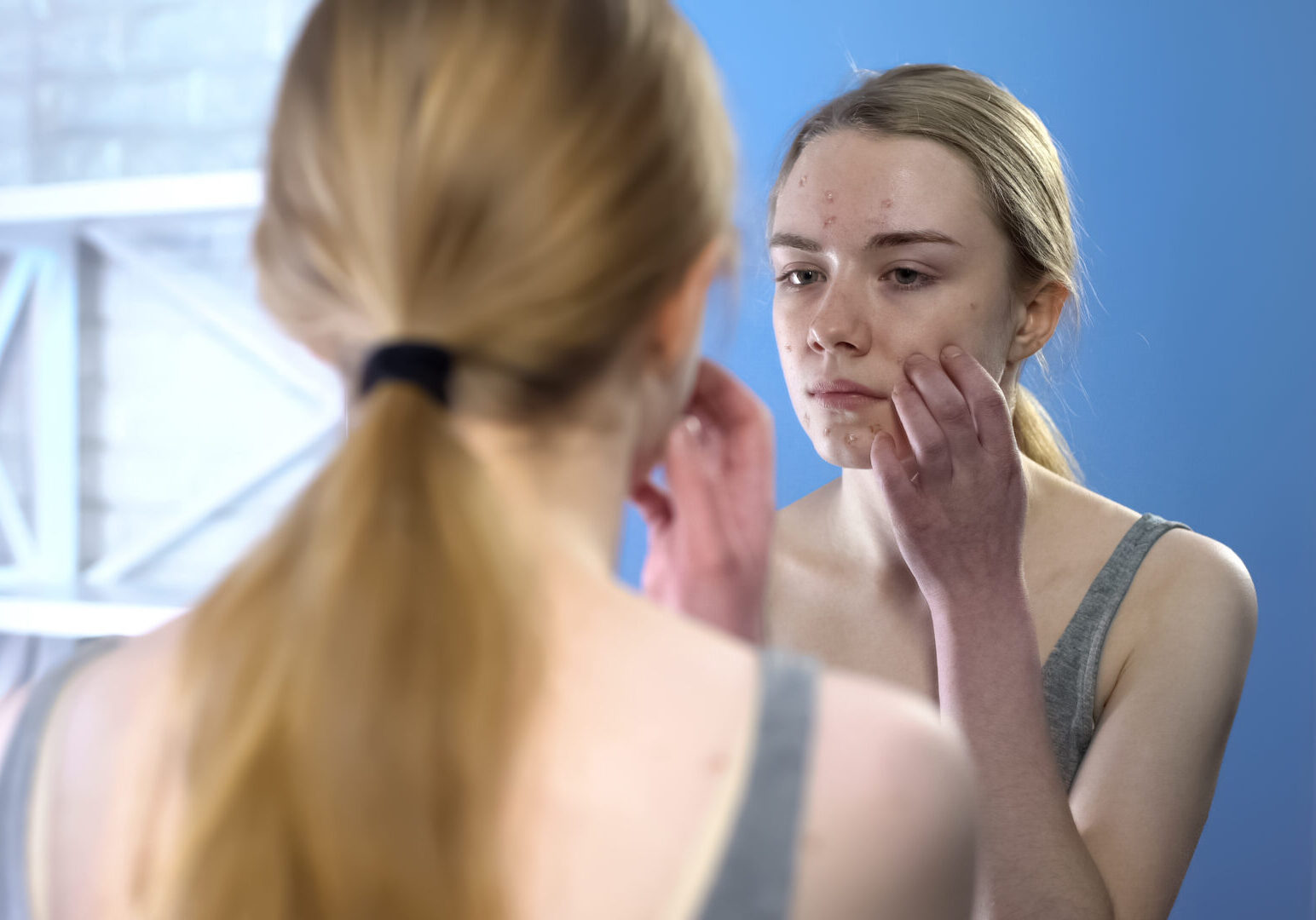 Young lady with face acne touching face in front of mirror, puberty skin problem